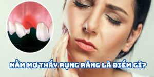 nằm mơ rụng răng là điềm gì